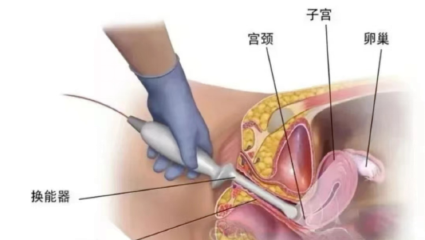 澳门一肖一码100准匠子,大学退休教授63小时卖出753台问界,创新典义解读_户外版V14.17